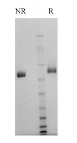 Gel: Novex 4-12% Bis-Tris<br />Load: Human Factor IX, 1 μg per lane<br />Buffer: MOPS<br />Standard: See Blue Plus 2; Myosin (191 kDa), Phosphorylase B (97 kDa), BSA (64 kDa), Glutamic Dehydrogenase (51 kDa), Alcohol Dehydrogenase (39 kDa), Carbonic Anhydrase (28 kDa), Myoglobin Red (19 kDa), Lysozyme (14 kDa)